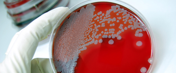 Close up of bacterial colonies in a Petri dish