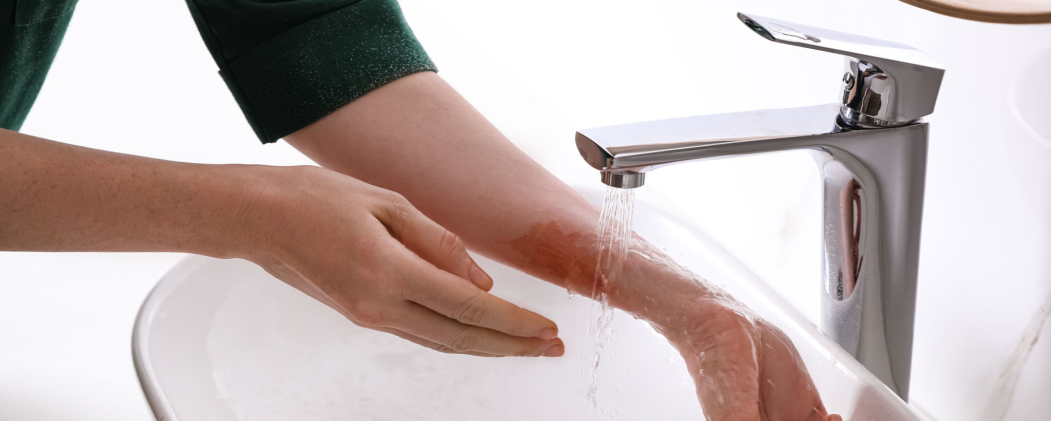 A woman holding a burn on her arm under cool water. 